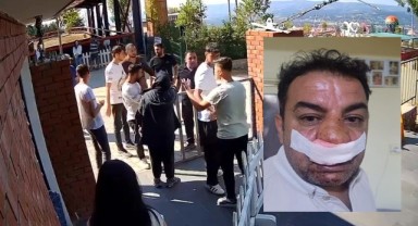 Turisti savunan tur şoförünün, burnunu kırdılar!